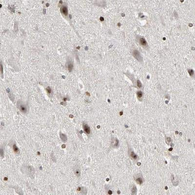 Immunohistochemistry-Paraffin: CPN2 Antibody [NBP1-90873]