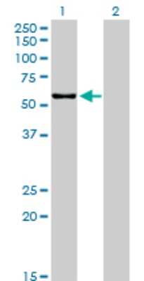 Western Blot: CPNE1 Antibody (8B8) [H00008904-M01]