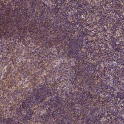 Immunohistochemistry-Paraffin: CPNE1 Antibody [NBP2-57519]