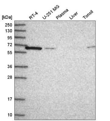 Western Blot: CPNE1 Antibody [NBP2-54980]