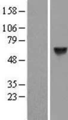 Western Blot: CPNE1 Overexpression Lysate [NBP2-10002]