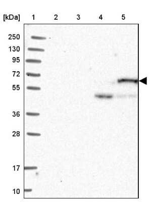 Western Blot: CPNE2 Antibody [NBP2-30692]