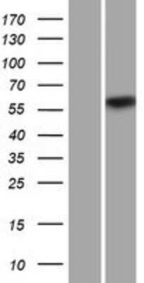 Western Blot: CPNE2 Overexpression Lysate [NBP2-05317]