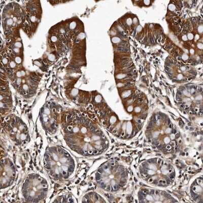 Immunohistochemistry-Paraffin: CPNE3 Antibody [NBP1-85939]