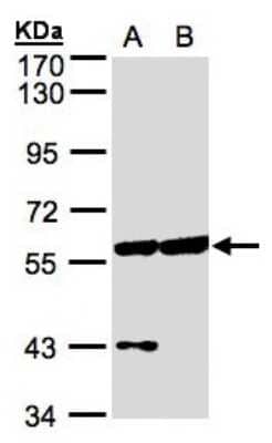 Western Blot: CPNE3 Antibody [NBP1-31453]