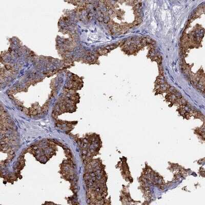 Immunohistochemistry-Paraffin: CPNE4 Antibody [NBP2-62723]