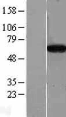 Western Blot: CPNE4 Overexpression Lysate [NBL1-09443]