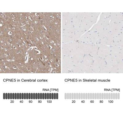 Immunohistochemistry-Paraffin: CPNE5 Antibody [NBP1-84406]