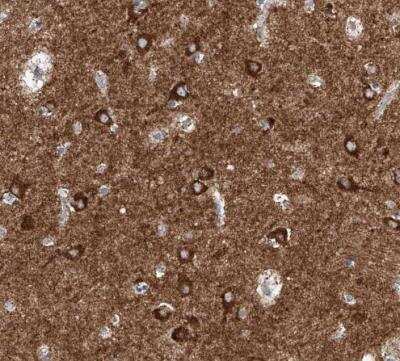 Immunohistochemistry-Paraffin: CPNE5 Antibody [NBP1-84406]