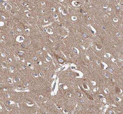 Immunohistochemistry-Paraffin: CPNE5 Antibody [NBP1-84406]