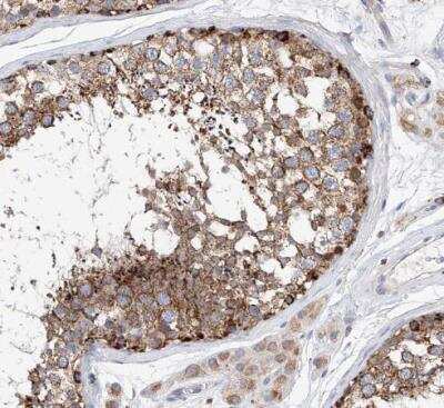 Immunohistochemistry-Paraffin: CPNE5 Antibody [NBP1-84406]