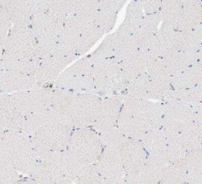 Immunohistochemistry-Paraffin: CPNE5 Antibody [NBP1-84406]