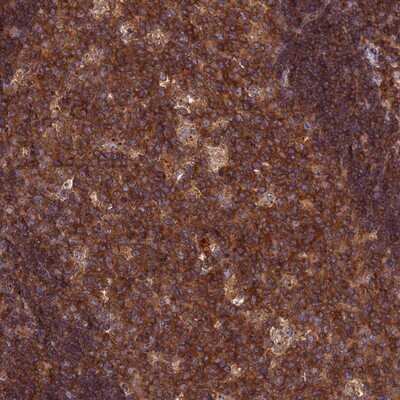 Immunohistochemistry-Paraffin: CPNE7 Antibody [NBP1-85827]