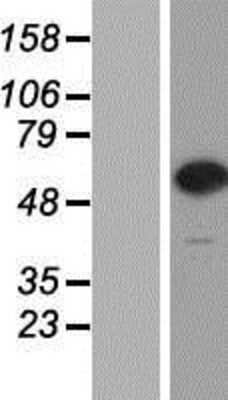 Western Blot: CPNE7 Overexpression Lysate [NBP2-05239]