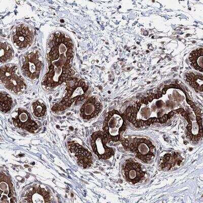 Immunohistochemistry: CPNE8 Antibody [NBP1-86255]