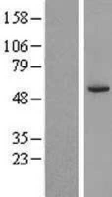 Western Blot: CPNE8 Overexpression Lysate [NBP2-05238]