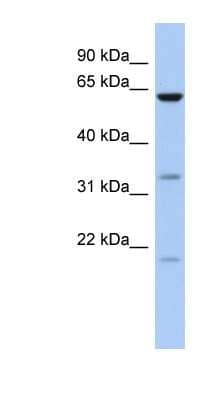 Western Blot: CPNE9 Antibody [NBP1-70508]