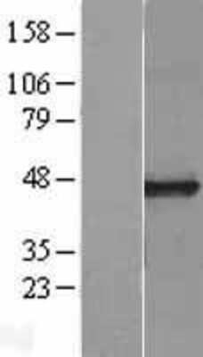 Western Blot: CPO Overexpression Lysate [NBL1-09445]