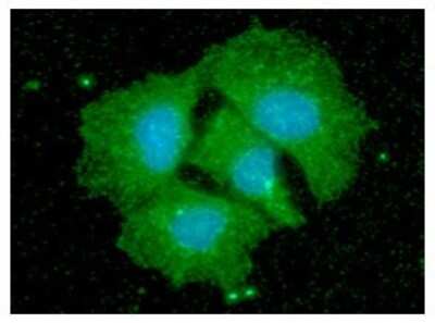 Immunocytochemistry/ Immunofluorescence: CPOX Antibody (36B10) - BSA Free [NBP2-59438]