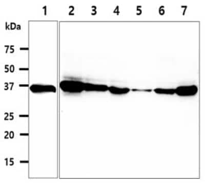 Western Blot: CPOX Antibody (36B10)BSA Free [NBP2-59438]