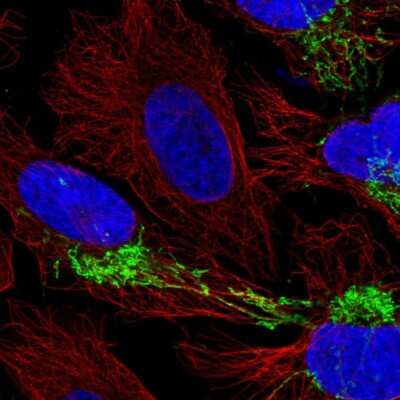 Immunocytochemistry/ Immunofluorescence: CPOX Antibody [NBP2-58431]