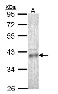 Western Blot: CPOX Antibody [NBP1-33665]