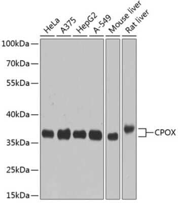 Western Blot: CPOX AntibodyBSA Free [NBP2-92779]