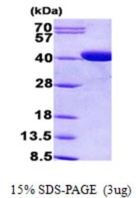 SDS-PAGE: Recombinant Human CPOX His Protein [NBP2-22799]