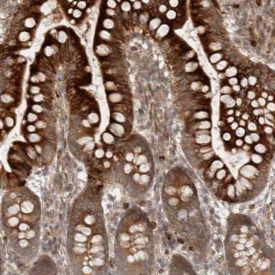 Immunohistochemistry-Paraffin: CPR8 Antibody [NBP1-87954]