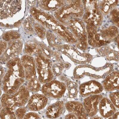 Immunohistochemistry-Paraffin: CPR8 Antibody [NBP1-87954]