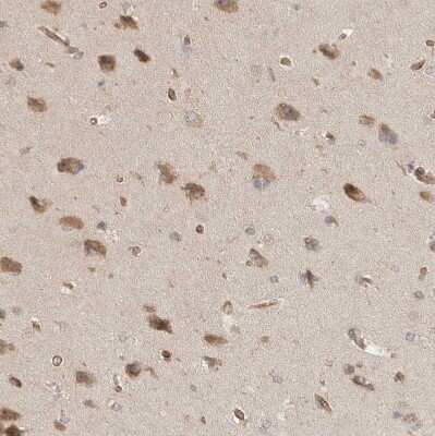 Immunohistochemistry-Paraffin: CPR8 Antibody [NBP1-87954]