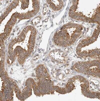 Immunohistochemistry-Paraffin: CPR8 Antibody [NBP1-87954]