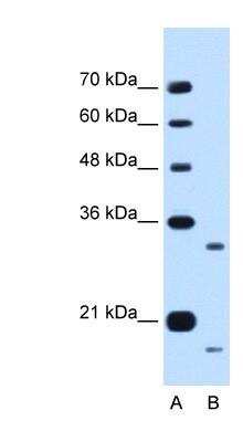 Western Blot: CPR8 Antibody [NBP1-70758]