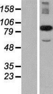 Western Blot: CPR8 Overexpression Lysate [NBP2-06619]