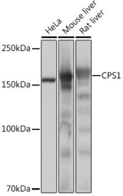 Western Blot: CPS1 Antibody (1R6W3) [NBP3-16357]