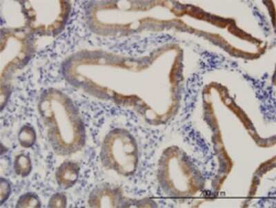 Immunohistochemistry-Paraffin: CPS1 Antibody (8H8) [H00001373-M01]