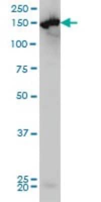 Western Blot: CPS1 Antibody (8H8) [H00001373-M01]
