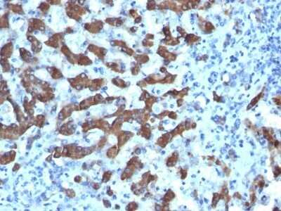 Immunohistochemistry-Paraffin: CPS1 Antibody (CPS1/1022) - Azide and BSA Free [NBP2-47904]