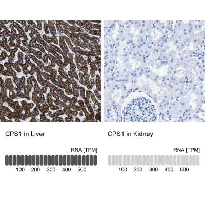 Immunohistochemistry-Paraffin: CPS1 Antibody [NBP1-86019]