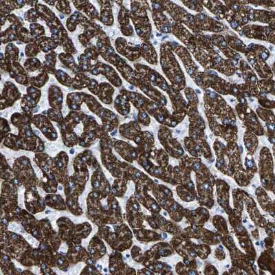 Immunohistochemistry-Paraffin: CPS1 Antibody [NBP1-86019]