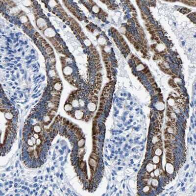 Immunohistochemistry-Paraffin: CPS1 Antibody [NBP1-86019]