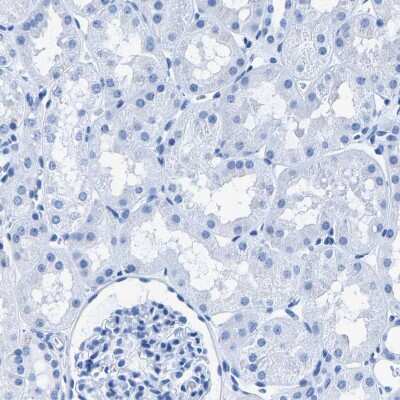 Immunohistochemistry-Paraffin: CPS1 Antibody [NBP1-86019]