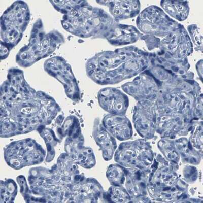 Immunohistochemistry-Paraffin: CPS1 Antibody [NBP1-86019]