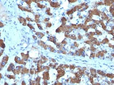 Immunohistochemistry-Paraffin: CPS1 Antibody (SPM615) - Azide and BSA Free [NBP2-47905]