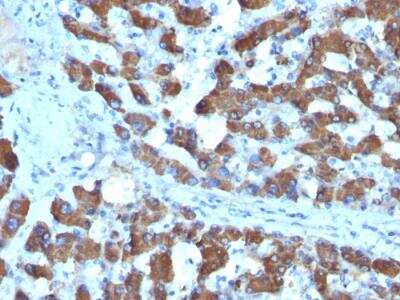 Immunohistochemistry-Paraffin: CPS1 Antibody (SPM615) - IHC-Prediluted [NBP2-48116]