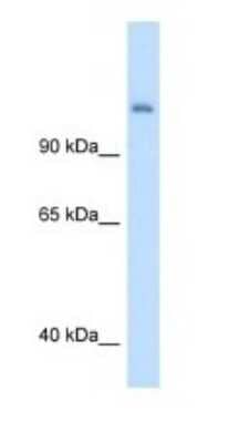 Western Blot: CPS1 Antibody [NBP1-54775]