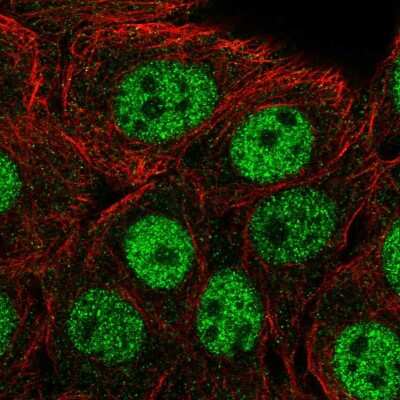 Immunocytochemistry/ Immunofluorescence: CPSF1 Antibody [NBP2-56229]