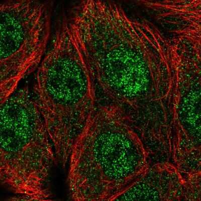 Immunocytochemistry/ Immunofluorescence: CPSF1 Antibody [NBP2-57024]