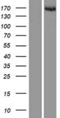 Western Blot: CPSF1 Overexpression Lysate [NBP2-07427]