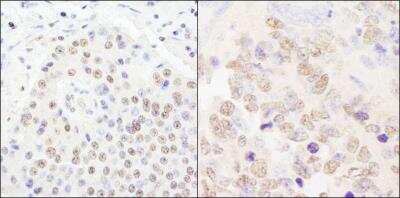 Immunohistochemistry-Paraffin: CPSF2 Antibody [NB100-79823]